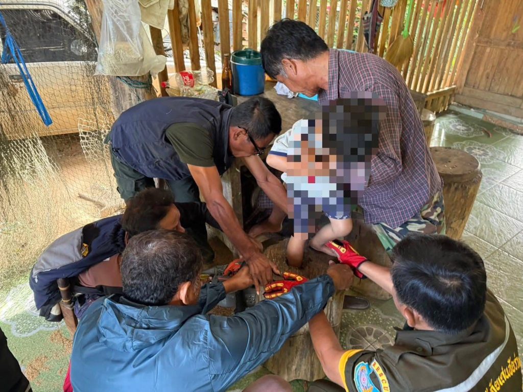 ระทึก !!!! สมาคมกู้ภัยเด่นชัยร่วมบุญ "เข้าช่วยเหลือ" เด็กชายขาติดร่องไม้ ต้องใช้เครื่องตัดถ่าง นำส่ง รพ.ยุพราชเด่นชัย 13 Talknews Online