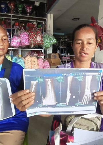 ชัยภูมิกระบะแหกโค้งชน จยย.นร.เจ็บสาหัสนอนติดเตียง8เดือนคดีไม่คืบไร้คนเยียวยา