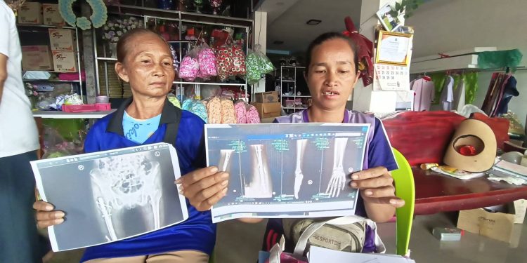 ชัยภูมิกระบะแหกโค้งชน จยย.นร.เจ็บสาหัสนอนติดเตียง8เดือนคดีไม่คืบไร้คนเยียวยา 12 ชัยภูมิกระบะแหกโค้งชน จยย.นร.เจ็บสาหัสนอนติดเตียง8เดือนคดีไม่คืบไร้คนเยียวยา